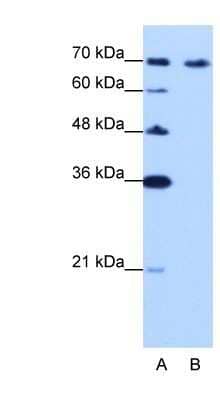 Western Blot: CARF/CDKN2AIP Antibody [NBP1-57236]