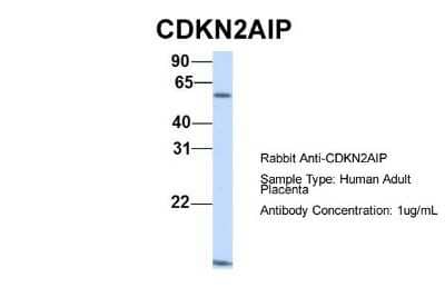 Western Blot: CARF/CDKN2AIP Antibody [NBP1-57555]
