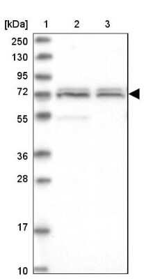 Western Blot: CARF/CDKN2AIP Antibody [NBP1-86628]