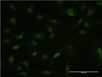 Immunocytochemistry/ Immunofluorescence: CARHSP1 Antibody (4G10) [H00023589-M08]