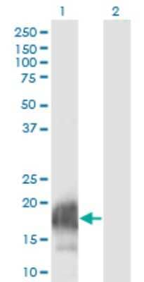 Western Blot: CARHSP1 Antibody (4G10) [H00023589-M08]