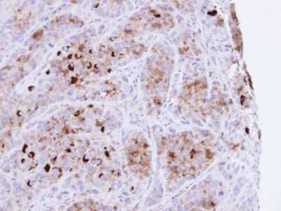 Immunohistochemistry-Paraffin: CARHSP1 Antibody [NBP1-31660]