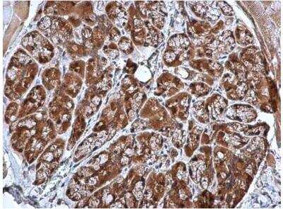 Immunohistochemistry-Paraffin: CARHSP1 Antibody [NBP1-31660]