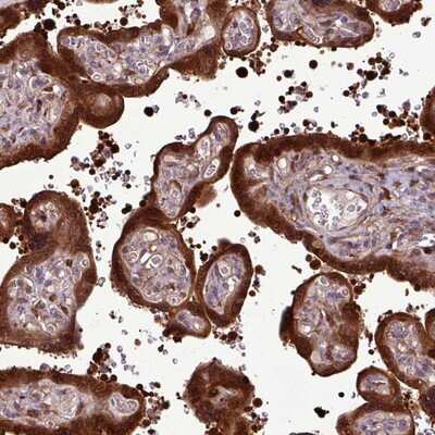 Immunohistochemistry-Paraffin: CARHSP1 Antibody [NBP2-14438]