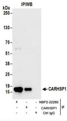Immunoprecipitation: CARHSP1 Antibody [NBP2-22260]