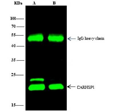 Immunoprecipitation: CARHSP1 Antibody [NBP3-00026]