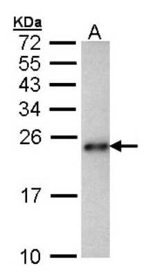 Western Blot: CARHSP1 Antibody [NBP1-31660]