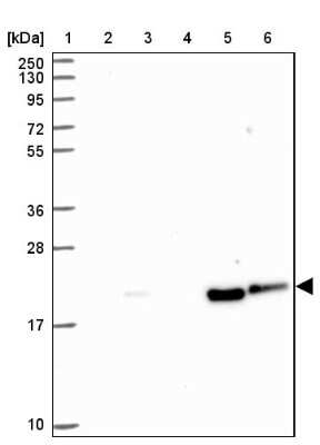 Western Blot: CARHSP1 Antibody [NBP2-14438]