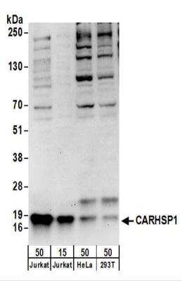 Western Blot: CARHSP1 Antibody [NBP2-22260]