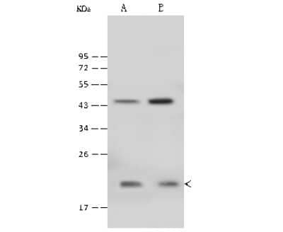 Western Blot: CARHSP1 Antibody [NBP2-99494]