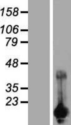 Western Blot: CARHSP1 Overexpression Lysate [NBP2-07354]