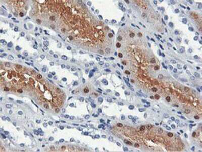 Immunohistochemistry-Paraffin: CARKL Antibody (OTI3D7) [NBP2-00986]