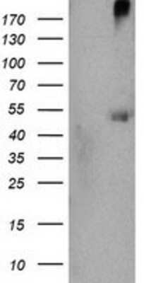 Western Blot: CARKL Antibody (OTI3D7) [NBP2-00986]