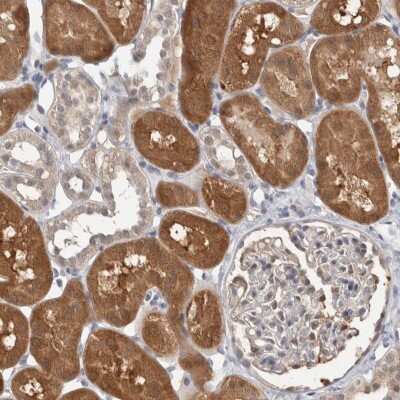 Immunohistochemistry-Paraffin: CARKL Antibody [NBP1-91151]