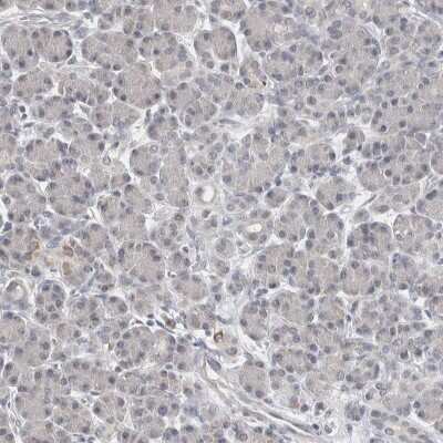 Immunohistochemistry-Paraffin: CARKL Antibody [NBP1-91151]