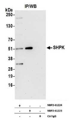 Immunoprecipitation: CARKL Antibody [NBP2-61224]