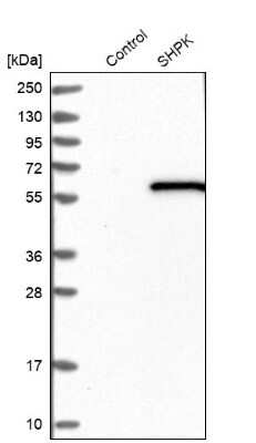 Western Blot: CARKL Antibody [NBP1-91151]