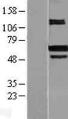 Western Blot: Carm1 Overexpression Lysate [NBL1-08698]