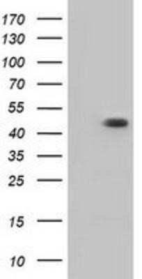 Western Blot: CARNMT1 Antibody (OTI4B7)Azide and BSA Free [NBP2-72398]