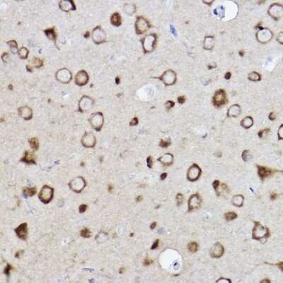 Immunohistochemistry-Paraffin: CARS Antibody (7V0X1) [NBP3-15264]