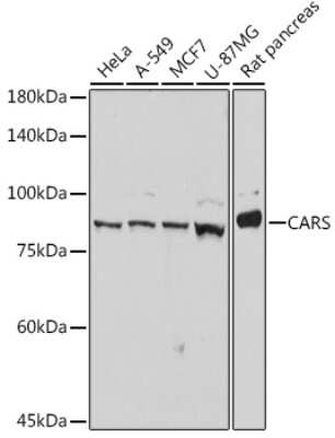 Western Blot: CARS Antibody (7V0X1) [NBP3-15264]