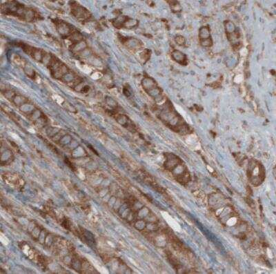 Immunohistochemistry: CARS Antibody (CL2302) [NBP2-36755]