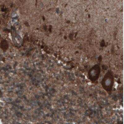 Immunohistochemistry: CARS Antibody (CL2302) [NBP2-36755]