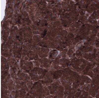 Immunohistochemistry: CARS Antibody (CL2302) [NBP2-36755]
