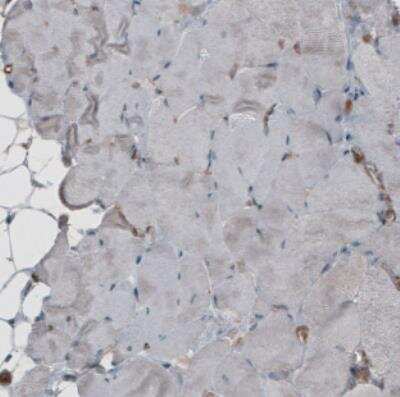 Immunohistochemistry: CARS Antibody (CL2302) [NBP2-36755]