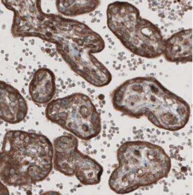 Immunohistochemistry: CARS Antibody (CL2304) [NBP2-36756]