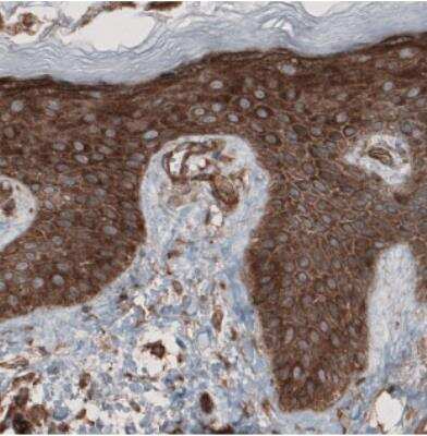 Immunohistochemistry: CARS Antibody (CL2304) [NBP2-36756]
