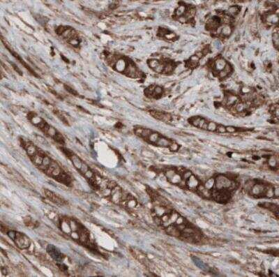 Immunohistochemistry: CARS Antibody (CL2304) [NBP2-36756]