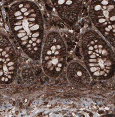 Immunohistochemistry: CARS Antibody (CL2304) [NBP2-36756]