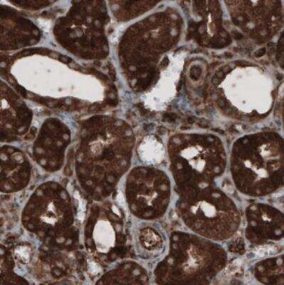 Immunohistochemistry: CARS Antibody (CL2304) [NBP2-36756]