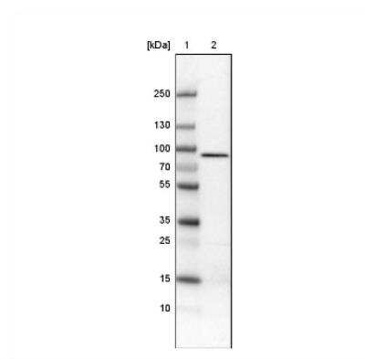 Western Blot: CARS Antibody (CL2304) [NBP2-36756]