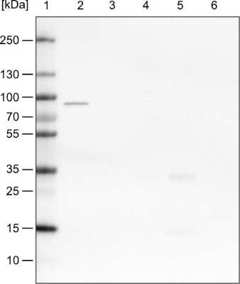 Western Blot: CARS Antibody (CL2304) [NBP2-36756]