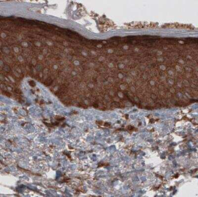 Immunohistochemistry: CARS Antibody (CL2309) [NBP2-36757]