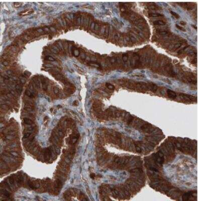 Immunohistochemistry: CARS Antibody (CL2309) [NBP2-36757]