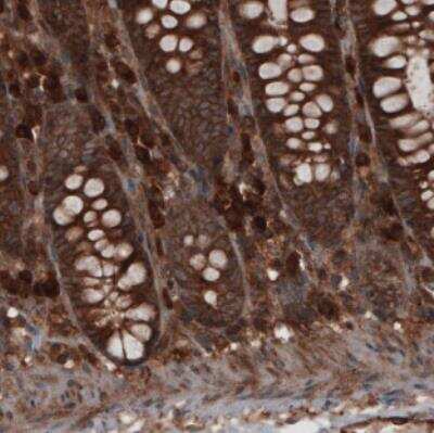 Immunohistochemistry: CARS Antibody (CL2309) [NBP2-36757]