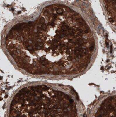 Immunohistochemistry: CARS Antibody (CL2309) [NBP2-36757]