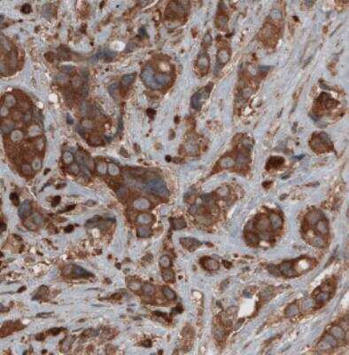 Immunohistochemistry: CARS Antibody (CL2309) [NBP2-36757]