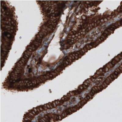 Immunohistochemistry: CARS Antibody (CL2310) [NBP2-36758]