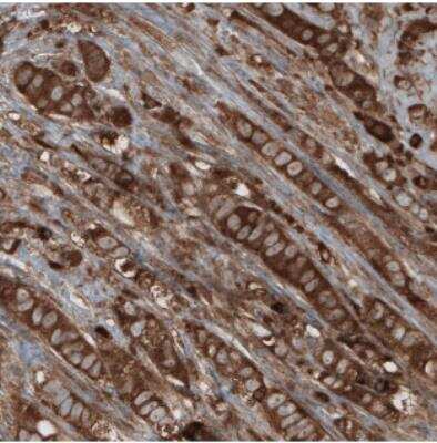 Immunohistochemistry: CARS Antibody (CL2310) [NBP2-36758]