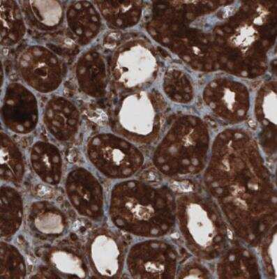 Immunohistochemistry: CARS Antibody (CL2310) [NBP2-36758]