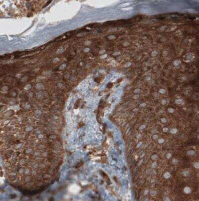 Immunohistochemistry: CARS Antibody (CL2310) [NBP2-36758]