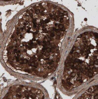 Immunohistochemistry: CARS Antibody (CL2310) [NBP2-36758]