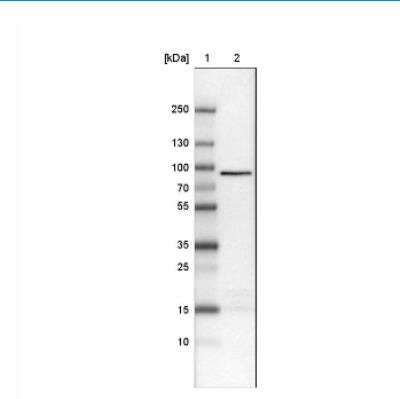 Western Blot: CARS Antibody (CL2310) [NBP2-36758]