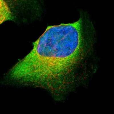 Immunocytochemistry/ Immunofluorescence: CARS Antibody [NBP1-86623]