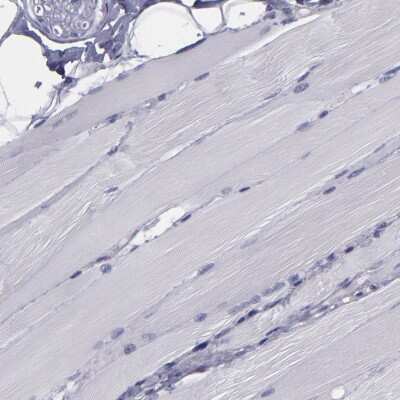Immunohistochemistry-Paraffin: CARS Antibody [NBP1-86623]