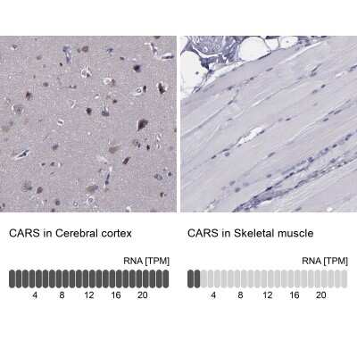 Immunohistochemistry-Paraffin: CARS Antibody [NBP1-86623]